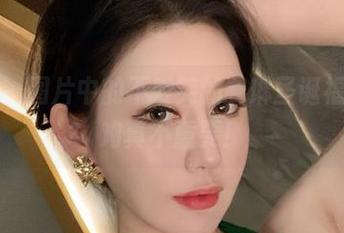 微密圈 – 图片中的不爱笑的赛琳圣诞福利，火鸡真不重要！